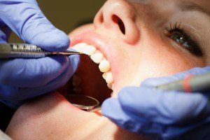 Importance Of Fluoride in Elkhart, IN Douglas J. Snyder DDS, PC