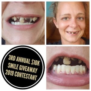  $10K Smile Giveaway! | Douglas Snyder, D.D.S